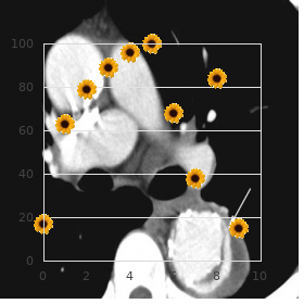 Hypothyroidism due to iodide transport defect