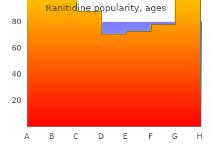 300mg ranitidine mastercard