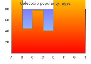 order 100 mg celecoxib fast delivery