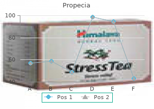 propecia 5mg sale