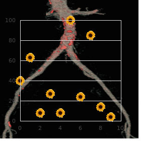 Infantile digital fibromatosis