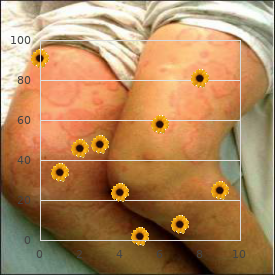 Diabetes insipidus, nephrogenic type 1