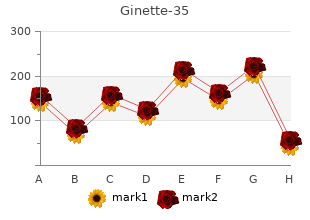 order ginette-35 2mg mastercard