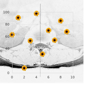 Microcephaly immunodeficiency lymphoreticuloma