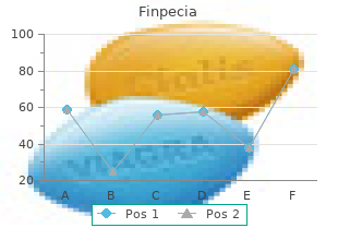 buy cheap finpecia 1mg line