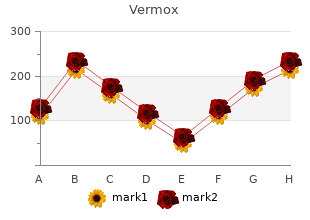 order vermox on line amex