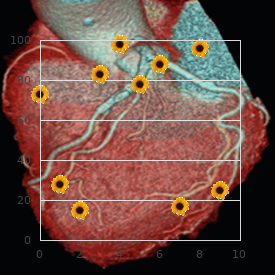 Malignant paroxysmal ventricular tachycardia