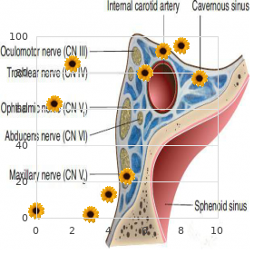 Berardinelli Seip congenital lipodystrophy