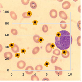 Hepatocellular carcinoma