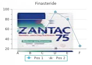 cheap finasteride 5 mg on line