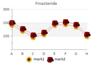 order finasteride 1 mg fast delivery