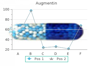 order cheap augmentin on-line