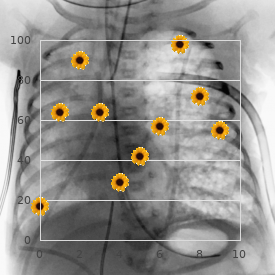 Blastoma