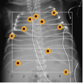 Renal tubular acidosis, distal