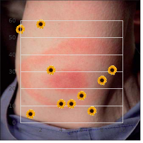 OSLAM syndrome