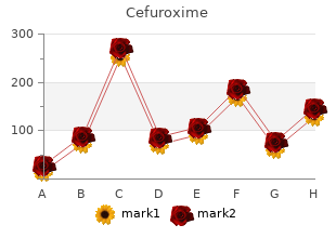 generic cefuroxime 250 mg without a prescription