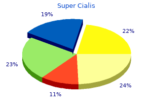 order 80mg super cialis with mastercard