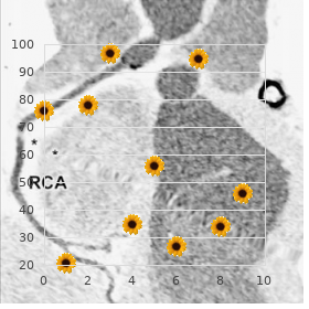 D-Glyceric acidemia