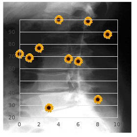 Tuberous Sclerosis, type 1