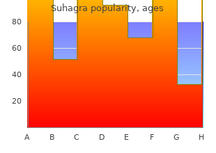 purchase suhagra without a prescription