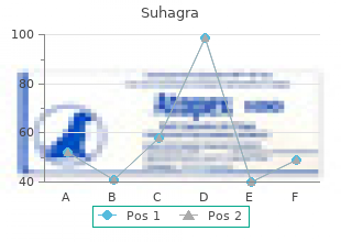 buy suhagra line